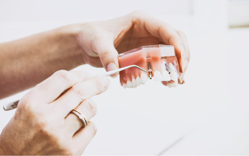 hands holding and showing dental implants model