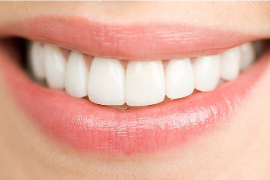 woman's closeup smile with dental veneers