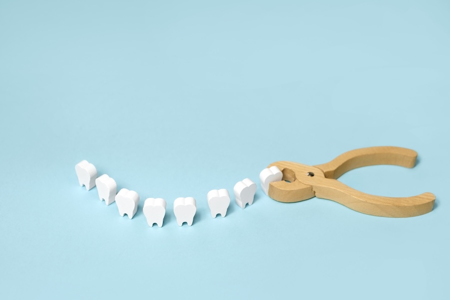 model of tooth extraction for when to eat after tooth extraction